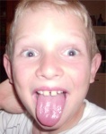 Tongue